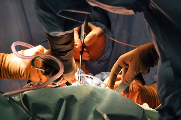 Cirurgias são um fator de risco para o desenvolvimento de embolia pulmonar.