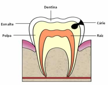 Esquema mostrando as partes do dente. 