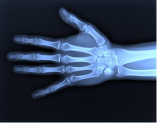 Radiografia de uma mão