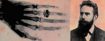 A maior surpresa de Röentgen foi verificar que os raios X permitiam visualizar os ossos de sua mão. 