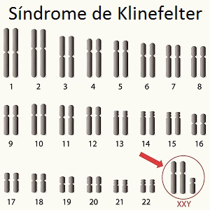 Observe a presença de dois cromossomos X e um Y